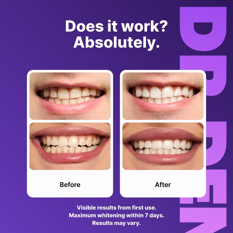 🔥2026 Hot Sale 48% OFF✨Purple Teeth Whitening Strips (42 Strips)